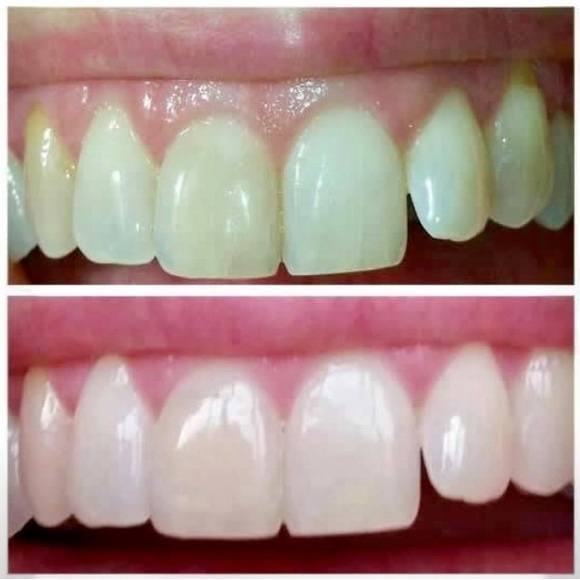 Whitening Toothpaste - Picture 15 of 16